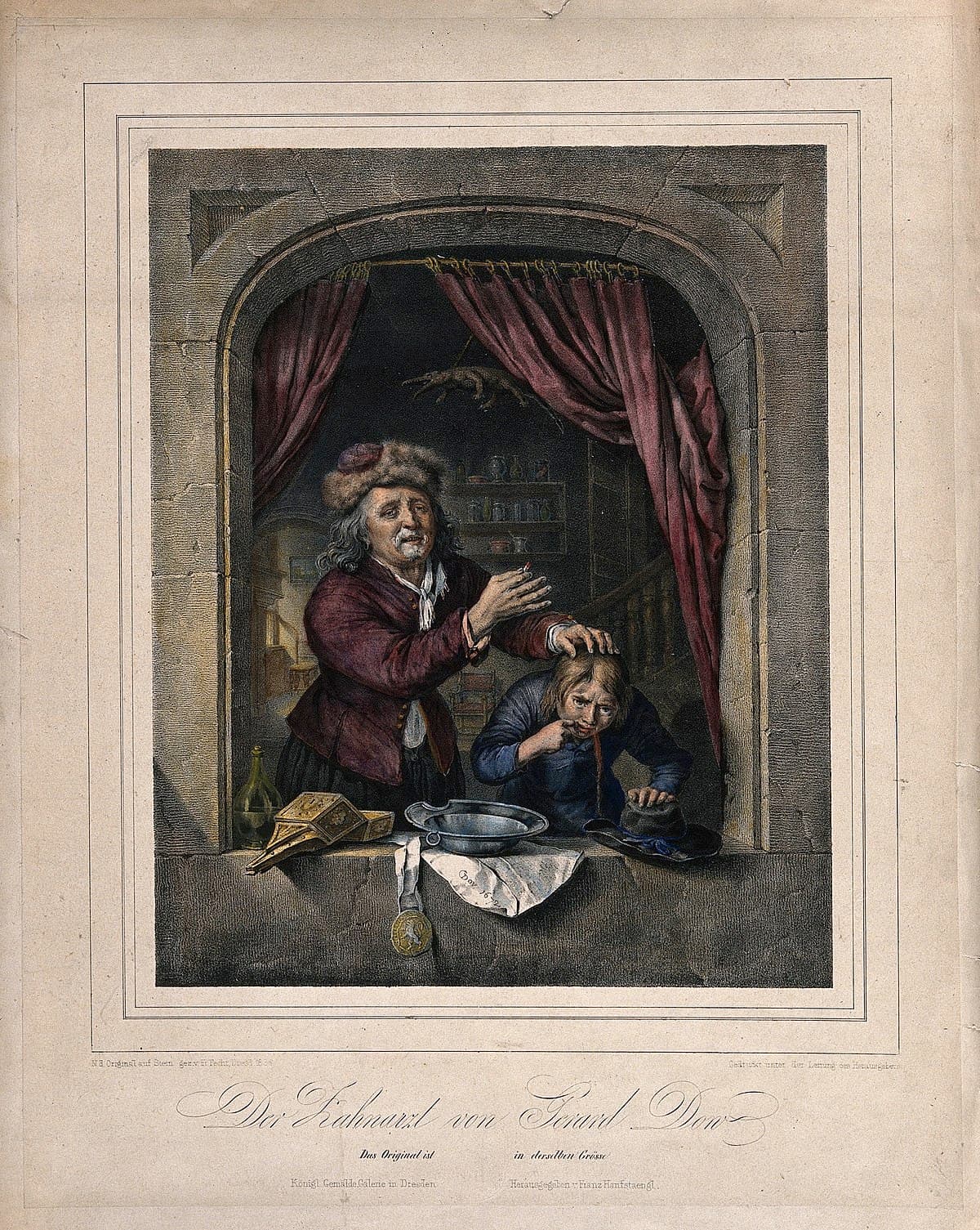The Extraction of Tooth