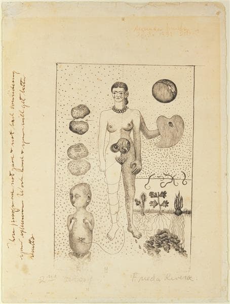 Frida and the Miscarriage by Frida Kahlo at Dolores Olmedo Collection, Mexico City